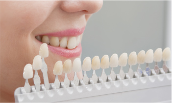 ホワイトニング | 四日市の歯医者 岩崎歯科 インプラント・入れ歯・矯正歯科・歯周病・予防歯科